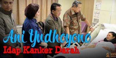 Ani Yudhoyono Idap Kanker Darah