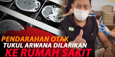 TUKUL ARWANA PENDARAHAN OTAK, MOHON DOANYA