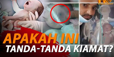 Kasus Langka Ada Bayi Bermata Satu di Yaman